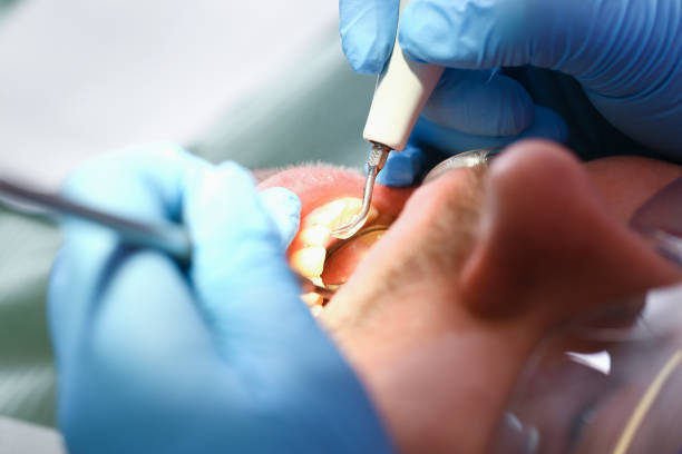 Best Urgent Tooth Repair  in Mars Hill, NC