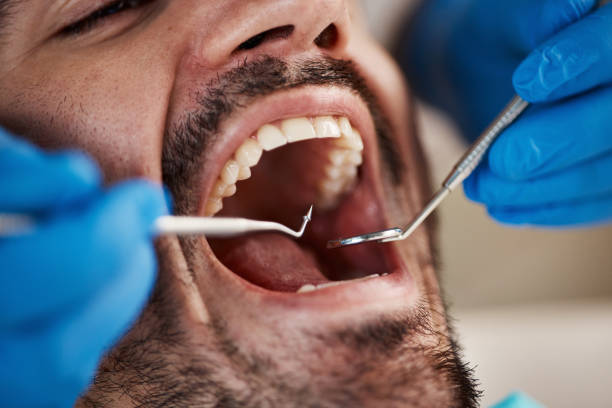 Best Urgent Tooth Repair  in Mars Hill, NC